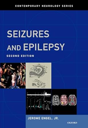 seizures and epilepsy 1st edition jerome engel jr 019532854x, 978-0195328547
