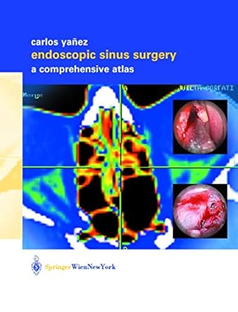 endoscopic sinus surgery a comprehensive atlas 1st edition carlos yanez 3211837124, 978-3211837122