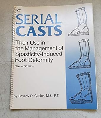 serial casts their use in the management of spasticity induced foot deformity 1st edition beverly d cusick