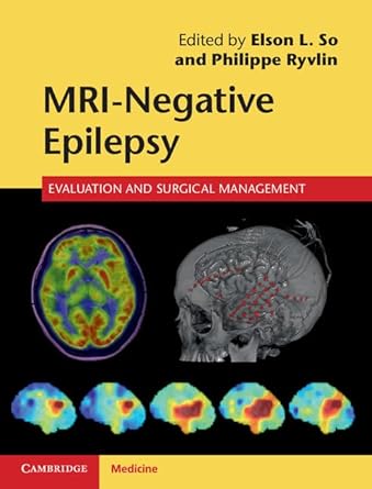 mri negative epilepsy evaluation and surgical management 1st edition elson l so ,philippe ryvlin 110703423x,