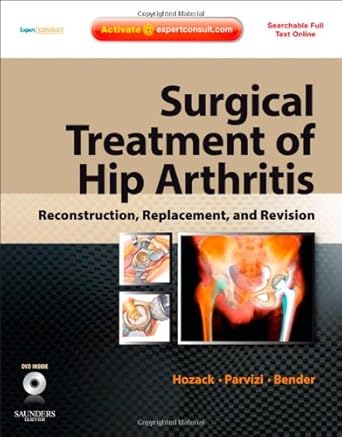 surgical treatment of hip arthritis reconstruction replacement and revision expert consult online and print
