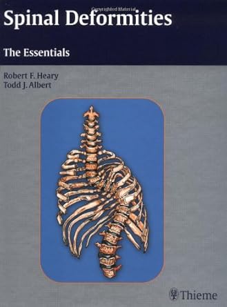 spinal deformities the essentials 1st edition robert f heary ,todd j albert 3131441216, 978-3131441218
