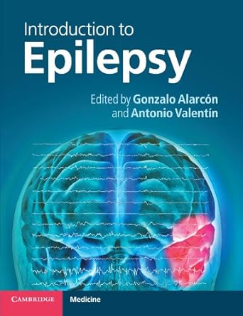introduction to epilepsy 1st edition gonzalo alarcon ,antonio valentin 0521691583, 978-0521691581