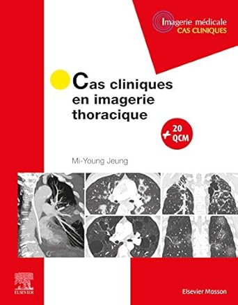 cas cliniques en imagerie thoracique 1st edition mi young jeung 2294759672, 978-2294759673