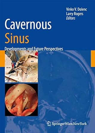 cavernous sinus developments and future perspectives 1st edition vinko v dolenc ,larry rogers 3211721371,