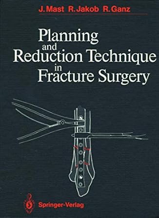 planning and reduction technique in fracture surgery 1st edition jeffrey mast ,roland jakob ,reinhold ganz ,j