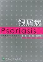 psoriasis 1st edition wang gang zhang kai ming bian zhu 7117066822, 978-7117066822