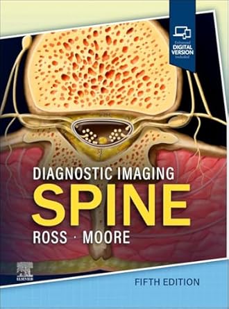 diagnostic imaging spine 1st edition jeffrey s ross md ,kevin r moore md 0443378819, 978-0443378812