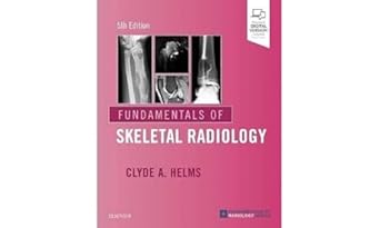 fundamentals of skeletal radiology 1st edition clyde a helms md 0323611656, 978-0323611657
