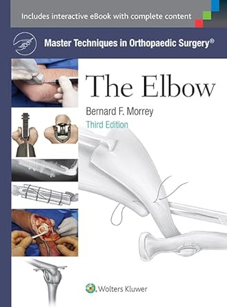 master techniques in orthopaedic surgery the elbow 1st edition bernard f morrey md 1451173091, 978-1451173093