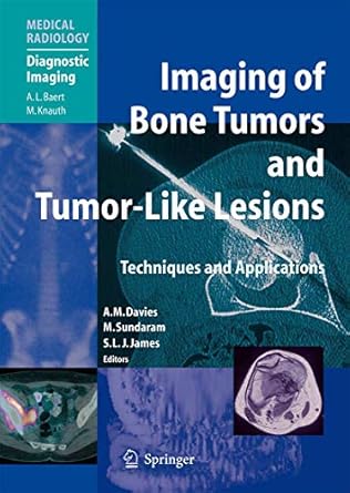 imaging of bone tumors and tumor like lesions techniques and applications 1st edition a mark davies ,murali