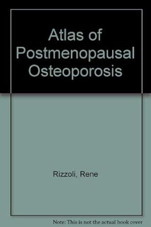 atlas of postmenopausal osteoporosis 1st edition rene rizzoli 2902050062, 978-2902050062