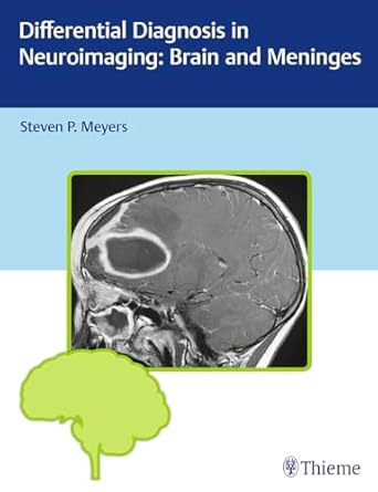differential diagnosis in neuroimaging brain and meninges 1st edition steven p meyers 1604067004,