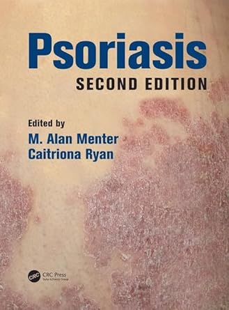 psoriasis 1st edition m alan menter ,caitriona ryan 1498700527, 978-1498700528