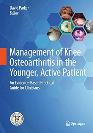 management of knee osteoarthritis in the younger active patient an evidence based practical guide for