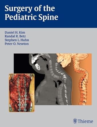surgery of the pediatric spine 1st edition betz huhn newton kim ,randal r betz ,stephen l huhn 3131419318,