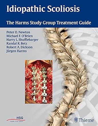 idiopathic scoliosis the harms study group treatment guide 1st edition peter newton ,harry shufflebarger