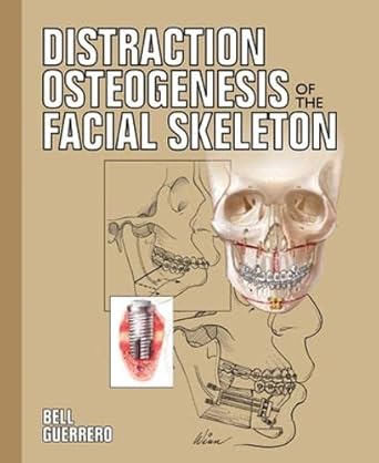 distraction osteogenesis of the facial skeleton 1st edition william h bell ,cesar a guerrero 1550093444,