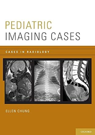 pediatric imaging cases 1st edition ellen chung 0199758964, 978-0199758968