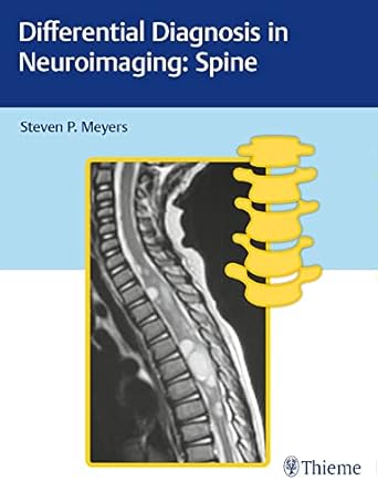 differential diagnosis in neuroimaging spine 1st edition steven meyers 1626234779, 978-1626234772