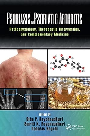 psoriasis and psoriatic arthritis 1st edition siba p raychaudhuri ,smriti raychaudhuri ,debasis bagchi