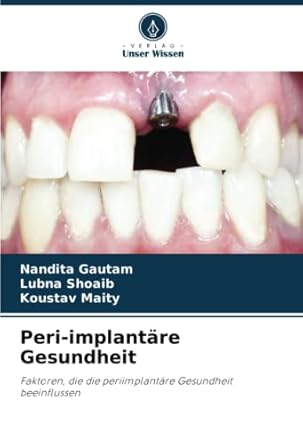 peri implantare gesundheit faktoren die die periimplantare gesundheit beeinflussen 1st edition nandita gautam