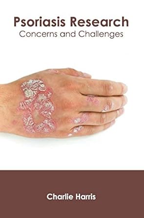 psoriasis research concerns and challenges 1st edition charlie harris 1632426226, 978-1632426222