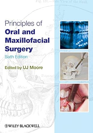 principles of oral and maxillofacial surgery 1st edition u j moore 1405199989, 978-1405199988