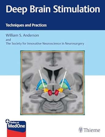 deep brain stimulation techniques and practices 1st edition william s anderson ,the society for innovative