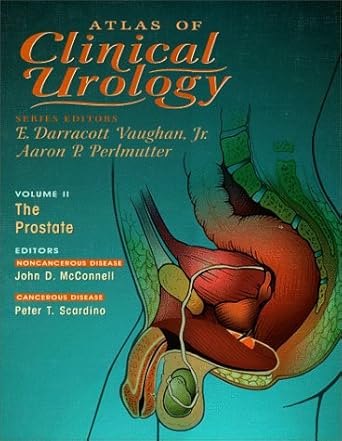 atlas of clinical urology volume 2 the prostate 1st edition ed vaughan, e darracott 1573401234, 978-1573401234