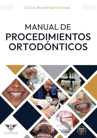 manual de procedimientos ortodonticos 1st edition ricardo garcia cuevas ,grupo igneo 6124967944,