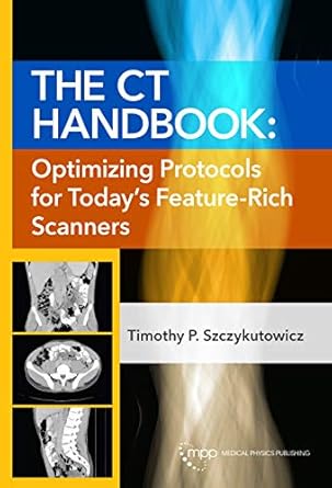 the ct handbook optimizing protocols for todays feature rich scanners 1st edition timothy p szczykutowicz