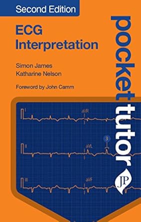 pocket tutor ecg interpretation 1st edition simon james ,katherine nelson 1909836710, 978-1909836716