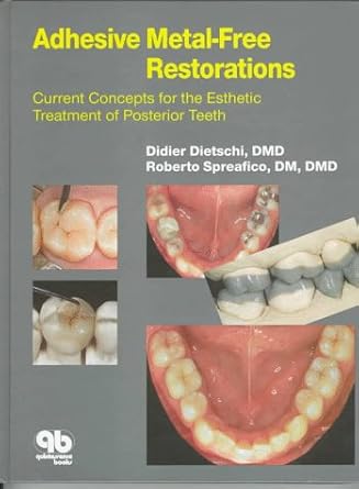 adhesive metal free restorations current concepts for the esthetic treatment of posterior teeth 1st edition