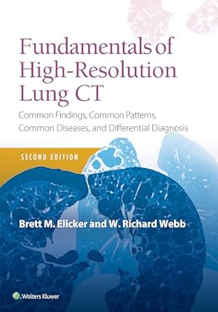 fundamentals of high resolution lung ct common findings common patterns common diseases and differential