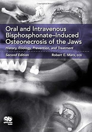 oral and intravenous bisphosphonate induced osteonecrosis of the jaws history etiology prevention and