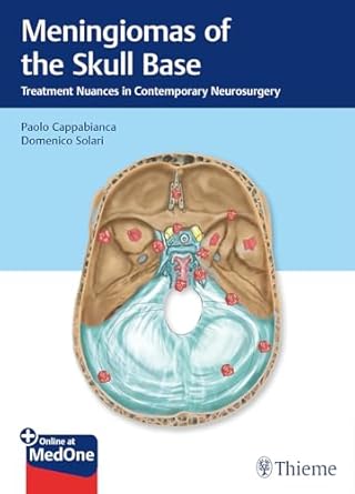 meningiomas of the skull base treatment nuances in contemporary neurosurgery 1st edition paolo cappabianca