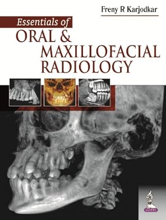 essentials of oral and maxillofacial radiology 1st edition freny r karjodkar 9351522296, 978-9351522294