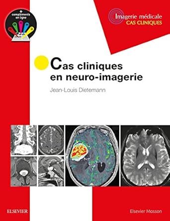 cas cliniques en neuro imagerie pathologies tumorales 1st edition jean louis dietemann 229475199x,
