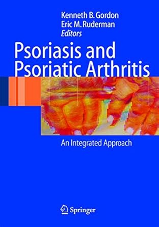 psoriasis and psoriatic arthritis an integrated approach 1st edition kenneth b gordon ,eric m ruderman