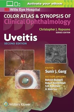 uveitis 1st edition sunir j garg 1496363000, 978-1496363008