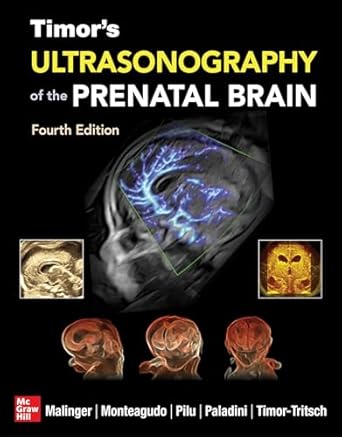timors ultrasonography of the prenatal brain 1st edition gustavo malinger ,ana monteagudo ,gianluigi pilu