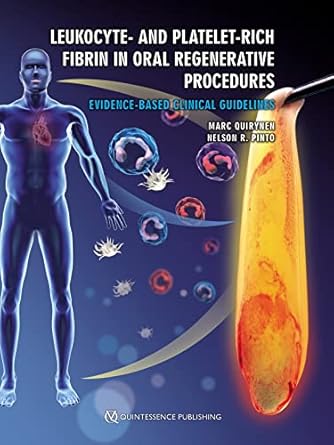 leukocyte and platelet rich fibrin in oral regenerative procedures evidence based clinical guidelines 1st