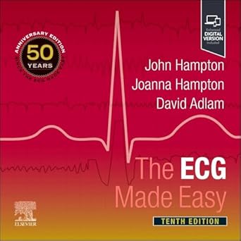 the ecg made easy 1st edition john hampton dm ma dphil frcp ffpm fesc ,joanna hampton md ma bm bch frcp