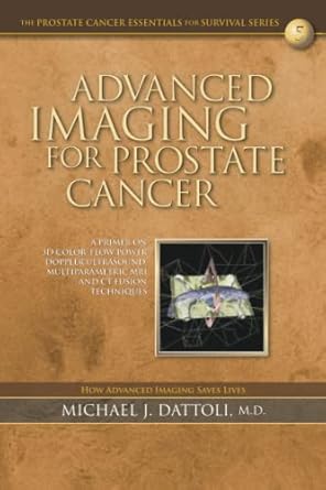 advanced imaging for prostate cancer a primer on 3d color flow power doppler ultrasound multiparametric mri