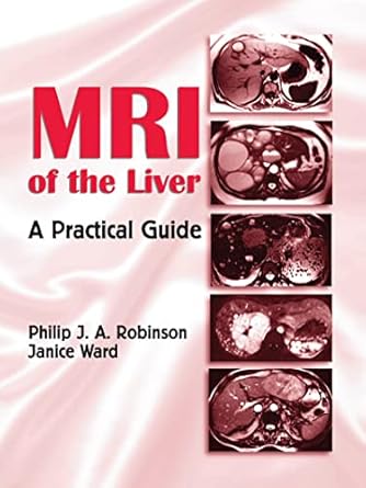 mri of the liver a practical guide 1st edition philip j a robinson ,janice ward 0824728718, 978-0824728939