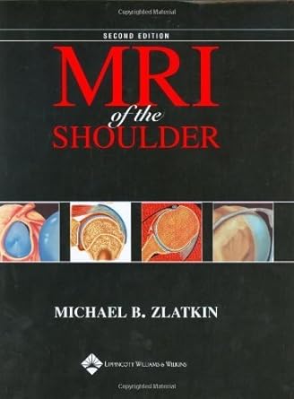 mri of the shoulder 1st edition michael b zlatkin 0781715903, 978-0781715904