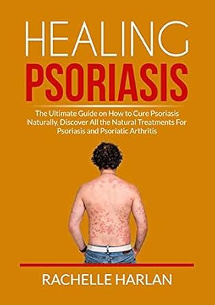healing psoriasis the ultimate guide on how to cure psoriasis naturally discover all the natural treatments