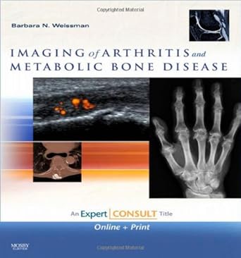 imaging of arthritis and metabolic bone disease expert consult online and print 1st edition barbara n w