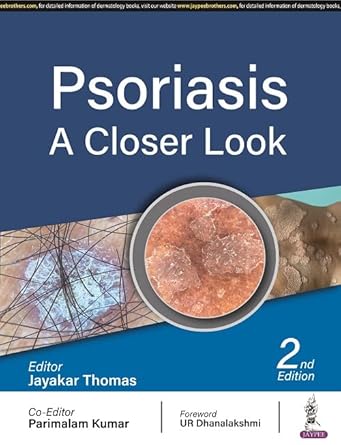 psoriasis a closer look 1st edition jayakar thomas 9354659802, 978-9354659805